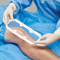 3M™ Tegaderm™ Absorbent Clear Acrylic Dressing covering a surgical incision on the knee.